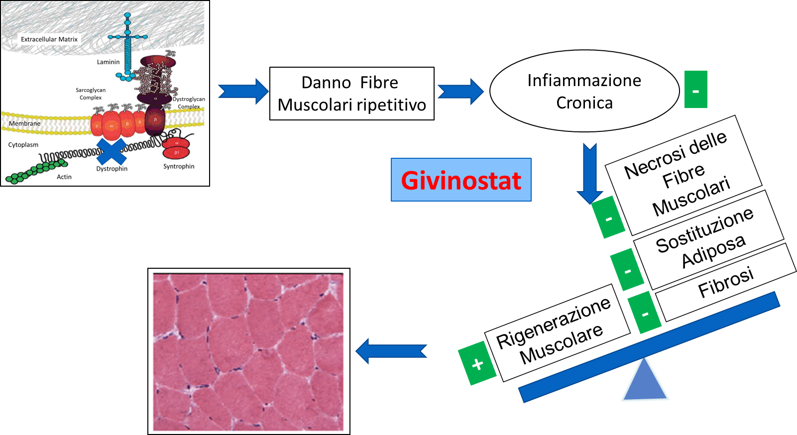 Muscolo distrofico in presenza di Givinostat